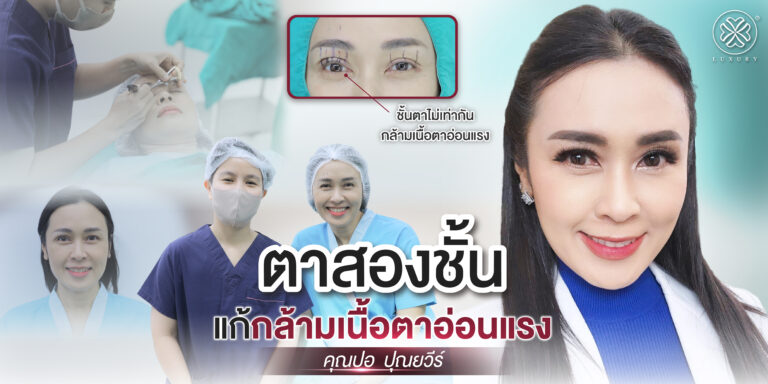 คุณปอ พิธีกรรายการดังกับการผ่าตัดครั้งใหญ่ “แก้กล้ามเนื้อตาอ่อนแรง” ที่ Luxury Clinic
